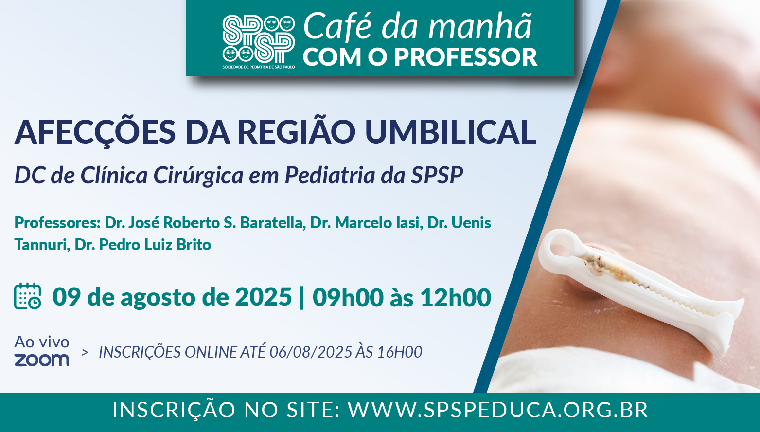 Afecções da Região Umbilical